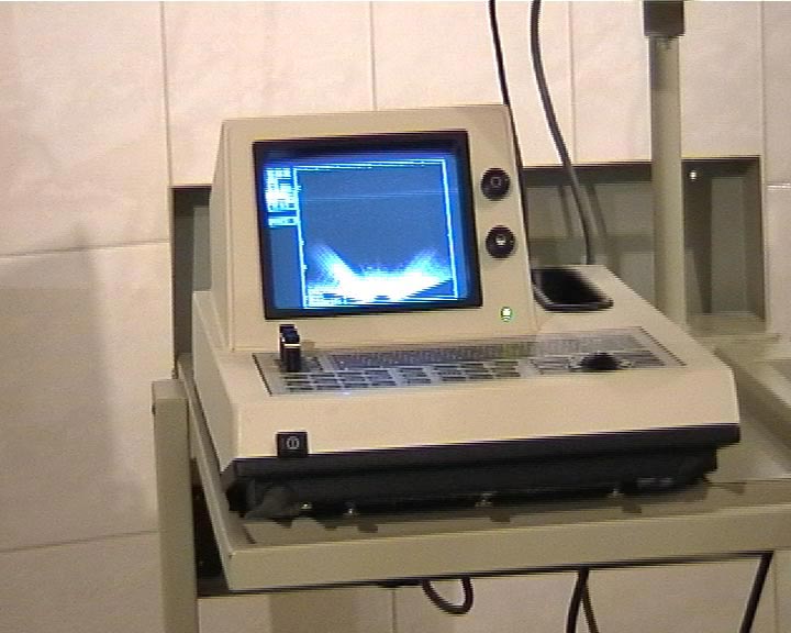 ultrasound gyngames gynexam nurse